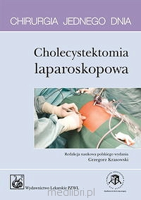 Chirurgia jednego dnia - Cholecystektomia laparoskopowa